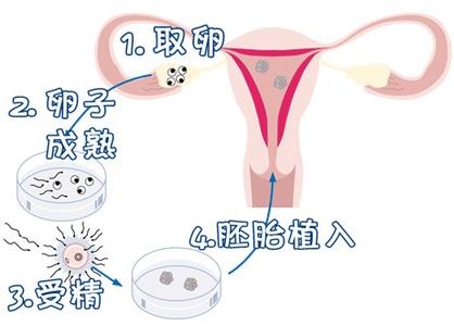 墨序生殖医学中心